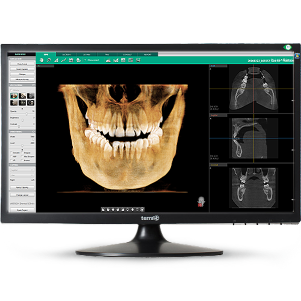 mockup_terra_ez3dI interface_logiciel_3d