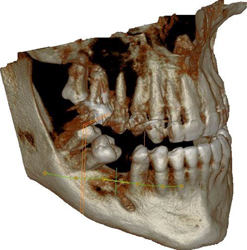 radiologie_dentaire_3D radiologie_dentaire_3d