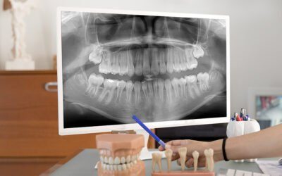 Ingénieur(e) Commercial(e) Radiologie Dentaire